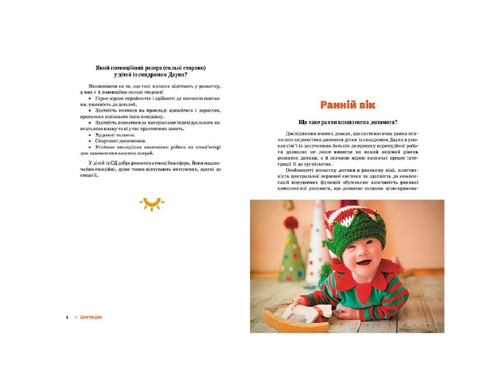Пособие "Солнечные дети. Дети с синдромом Дауна", А. Чеботарева, И. Гладченко, Кенгуру